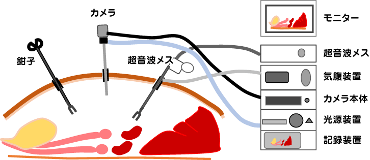 腹腔鏡での避妊手術